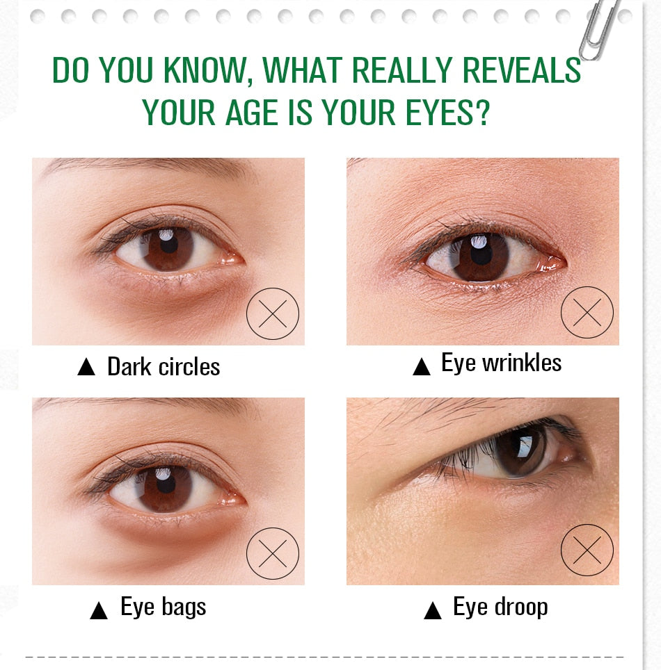 Anti Dark Circle Eye Cream