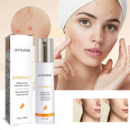 Jayusing Anti-Acne And Anti-Acne Serum, Reduce Acne And Acne Mark Moisturizing Skin Repair Serum