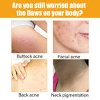 Jayusing Anti-Acne And Anti-Acne Serum, Reduce Acne And Acne Mark Moisturizing Skin Repair Serum