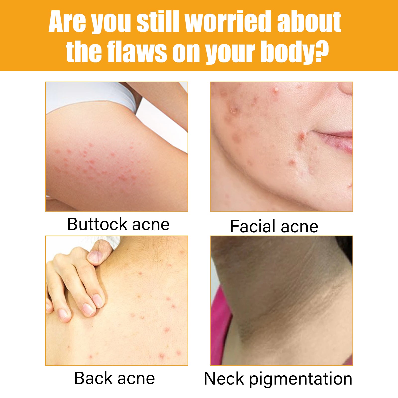 Jayusing Anti-Acne And Anti-Acne Serum, Reduce Acne And Acne Mark Moisturizing Skin Repair Serum