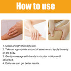 Jayusing Anti-Acne And Anti-Acne Serum, Reduce Acne And Acne Mark Moisturizing Skin Repair Serum